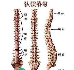 强直性脊柱炎患者在生活里应该注意什么？