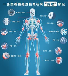 强直关节到底是什么情况？你确定你知道吗？